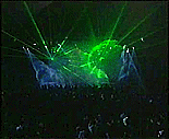 YAG LASER Concert System